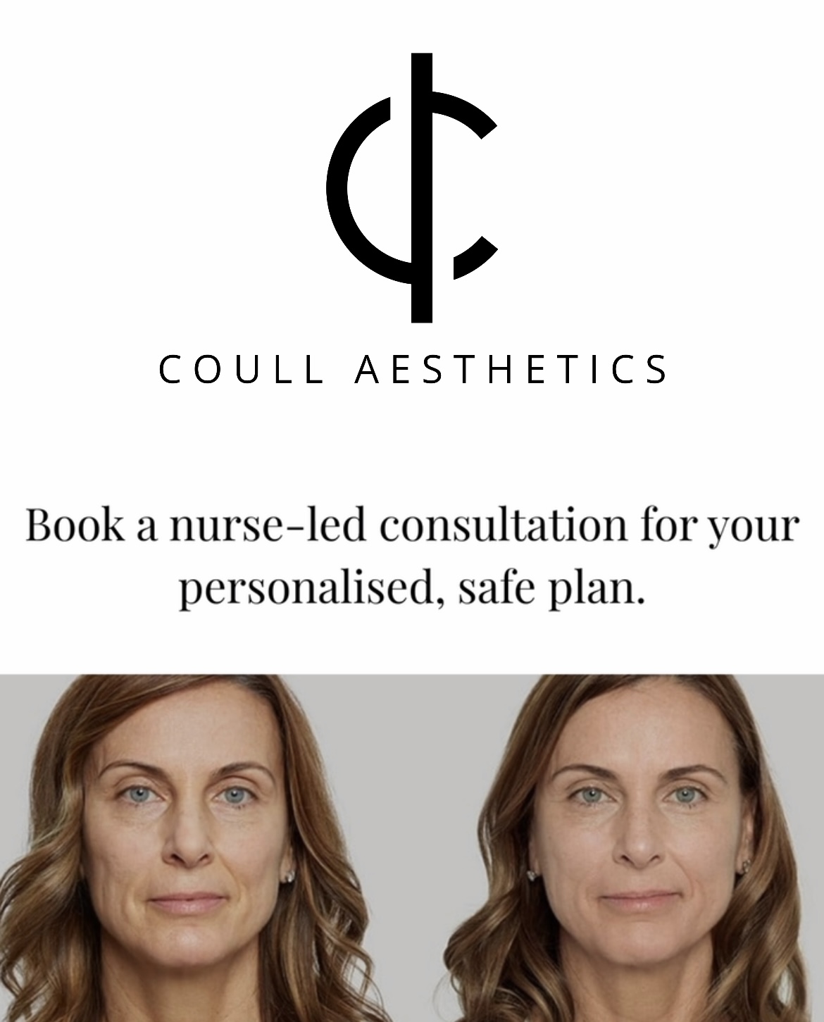 Sculptra consultation photograph at Coull Aesthetics