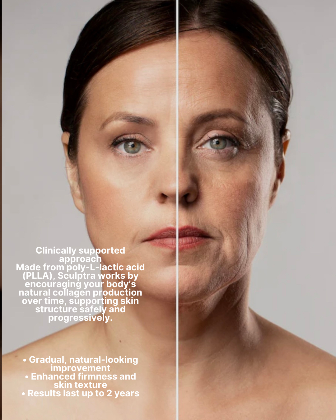 Sculptra collagen stimulation information photograph